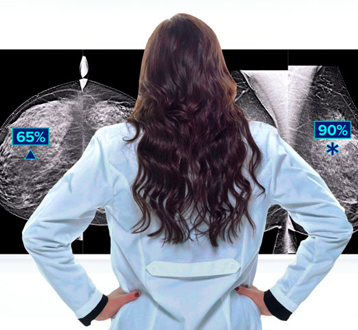 Hologic Genius AI™ Erkennungstechnologie mit weißem Hintergrund