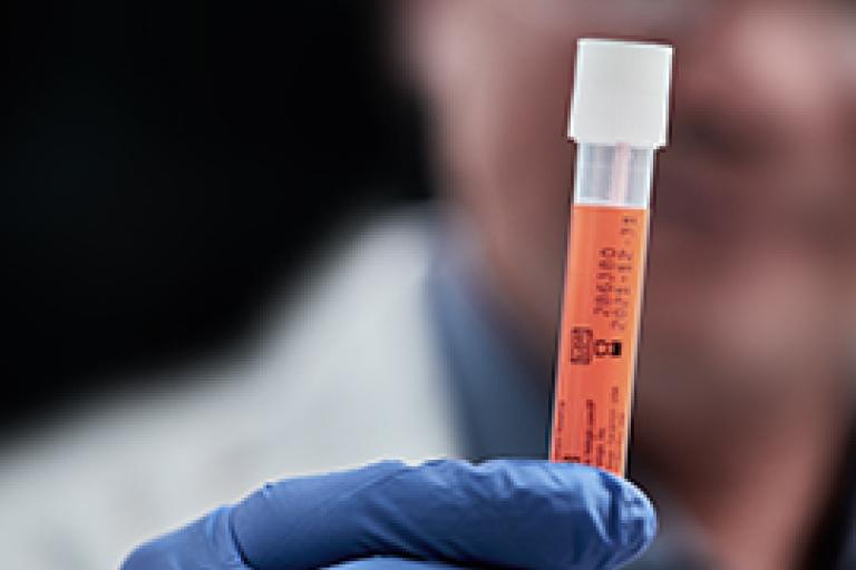 Hand mit Handschuh und Fläschchen