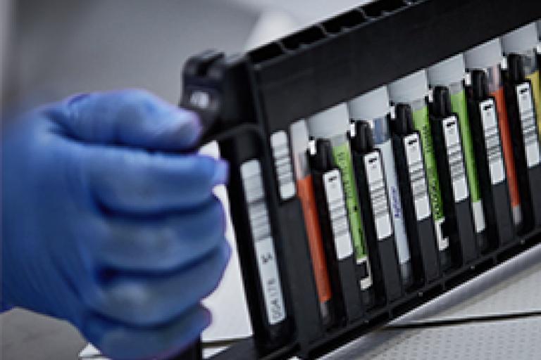 Hand mit Handschuh und einem Fläschchen-Rack