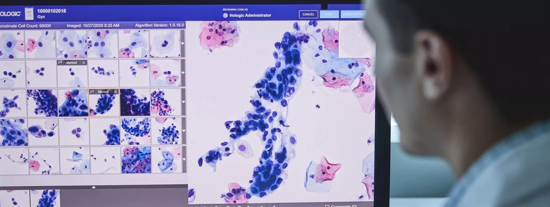 Abbildung des Genius™ Digital Diagnostics System
