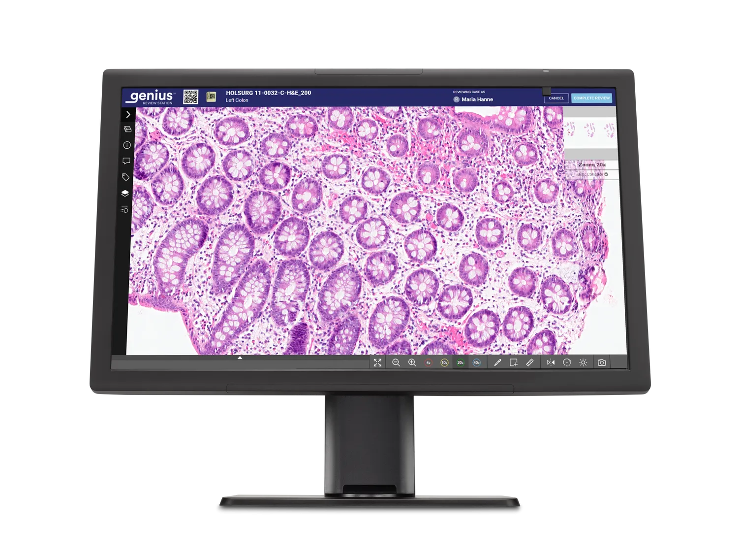 Genius-Monitor mit Zellen eines histologischen Präparates für die Befundung 