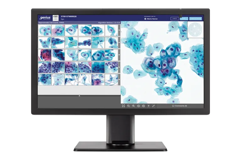 Genius-Monitor mit Zellen eines zytologischen Präparates für die Befundung