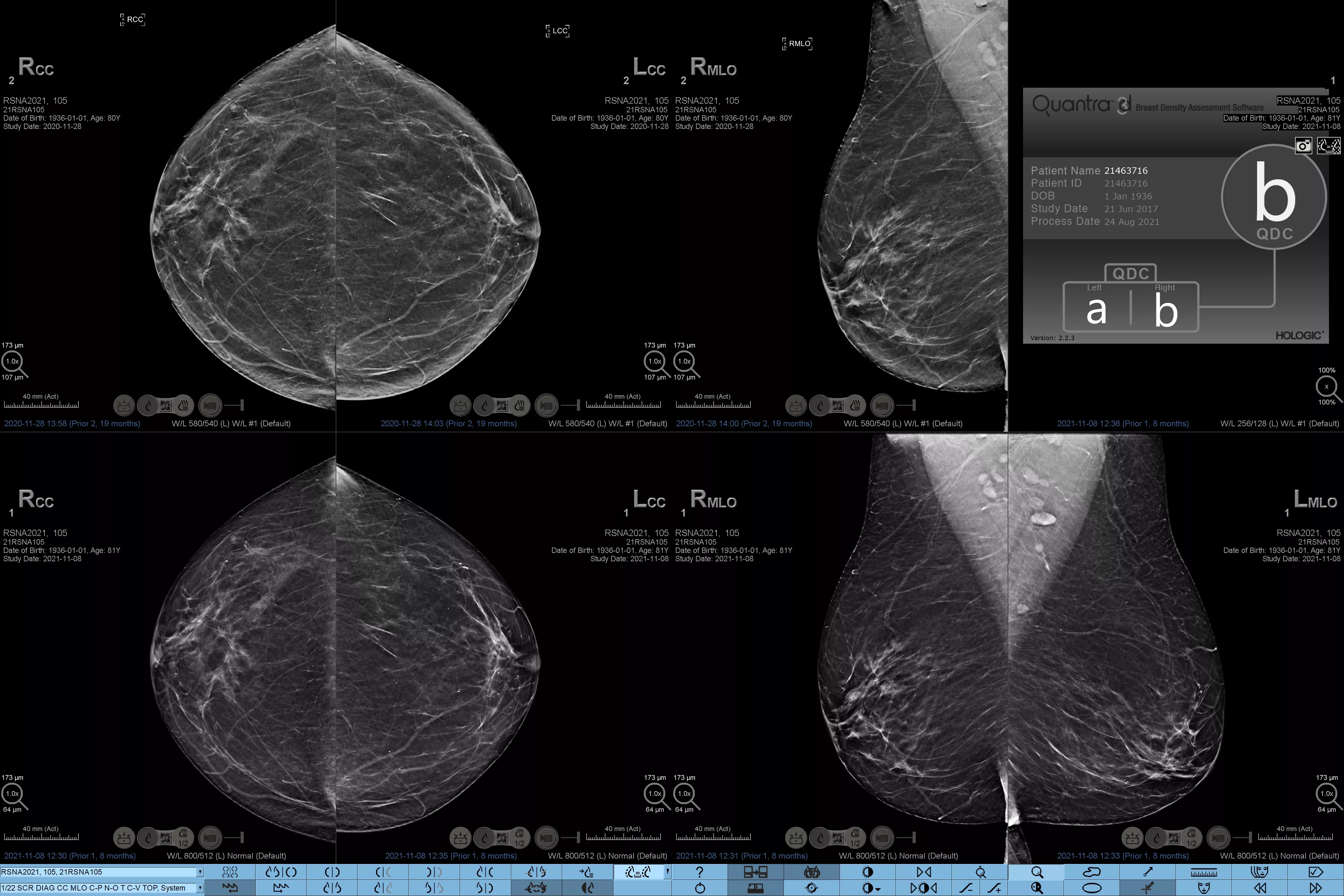 Schallkopf-L18-5 auf weißem Hintergrund