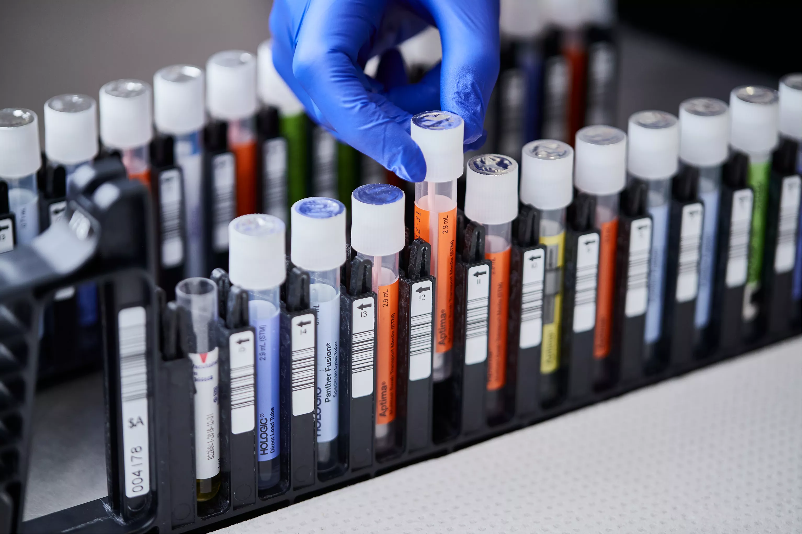 Behandschuhte Hand bei der Entnahme eines Fläschchens aus dem Tray