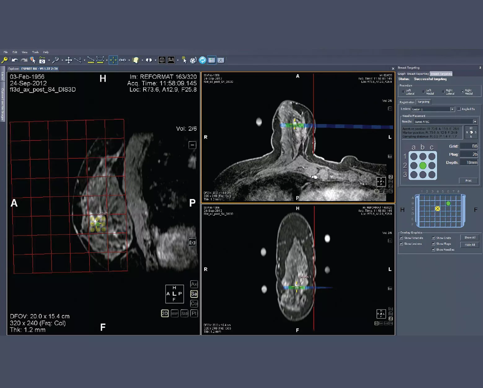 MultiView-Screenshot