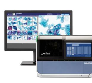 Hologic Genius™ Digital Diagnostics System auf weißem Hintergrund
