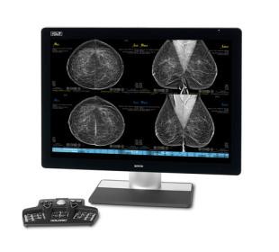 Hologic SecurView® Workstation für die Brustbildgebung auf weißem Hintergrund