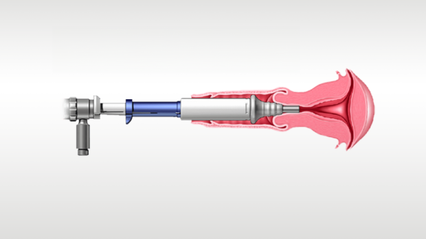 Abbildung eines Medizinprodukts beim Einsatz.